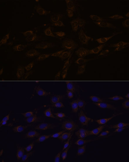 RGS4 Rabbit Polyclonal Antibod