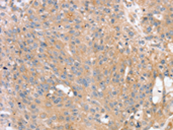 PTX3 Antibody[43163]