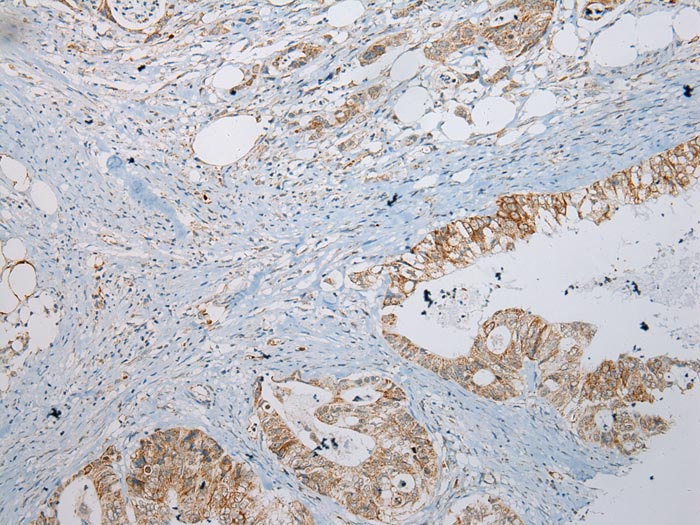 MGST1 Antibody[43149]