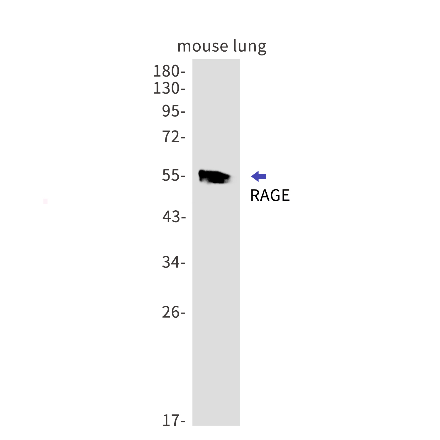 RAGE Rabbit mAb[52544]