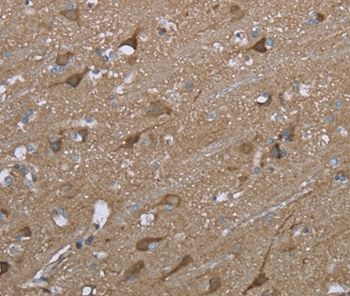 PTK2B Antibody[36460]