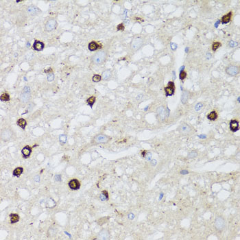 AQP0 antibody[38479]