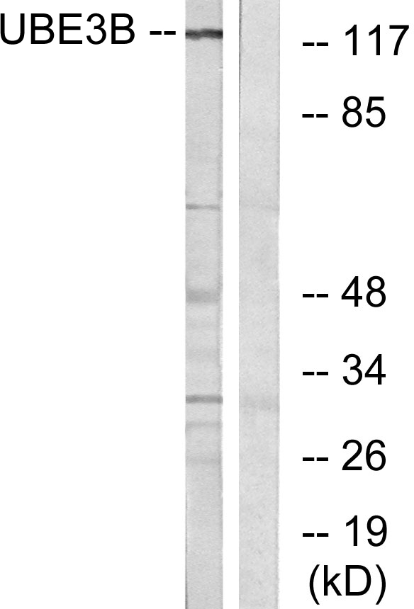 UBE3B antibody[62234]