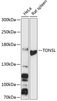 TONSL Rabbit Polyclonal Antibo