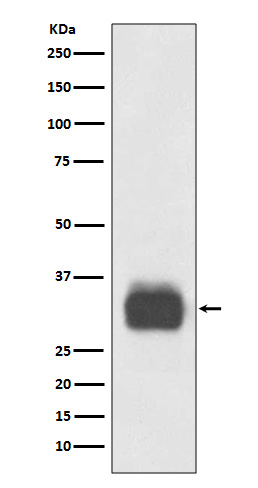 Mast Cell Tryptase Rabbit mAb[
