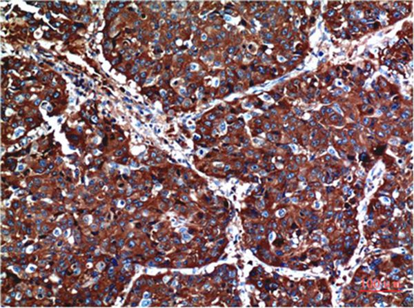 AKT Mouse Monoclonal Antibody(