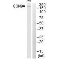 SCN9A Antibody[35056]