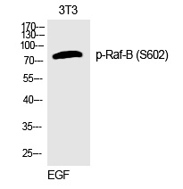 Raf-B (Phospho-Ser602) Polyclo