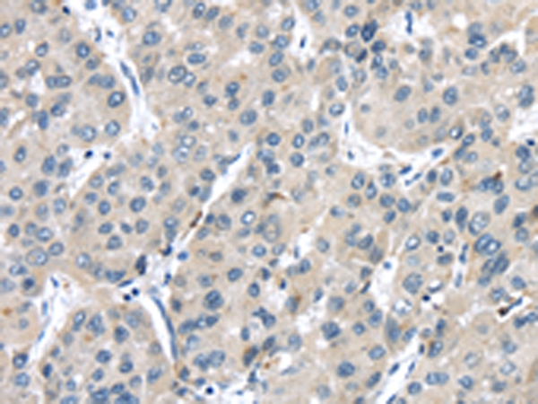TRPM2 Antibody[42793]