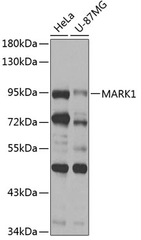 MARK1 Rabbit Polyclonal Antibo