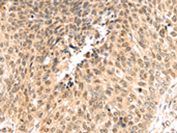 PSMB8 Antibody[43134]