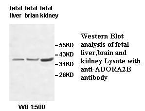 ADORA2B Antibody[39513]