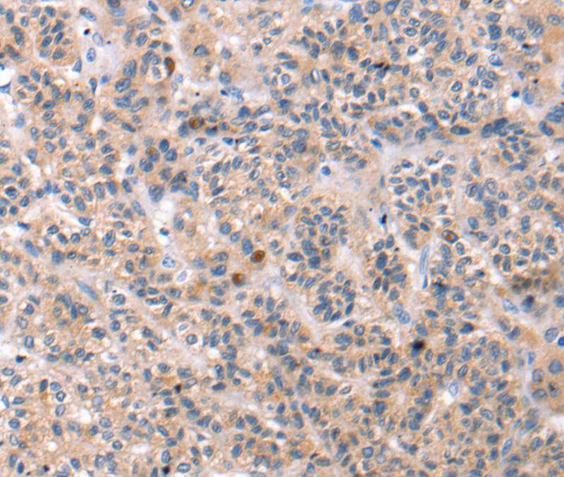 TCERG1L Antibody[40240]