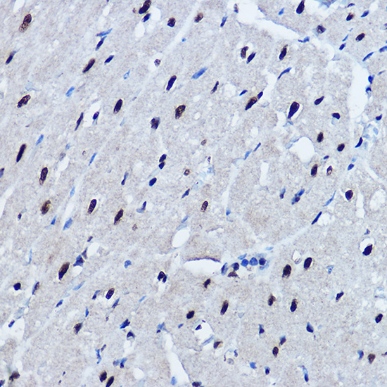 TARDBP Rabbit Polyclonal Antib