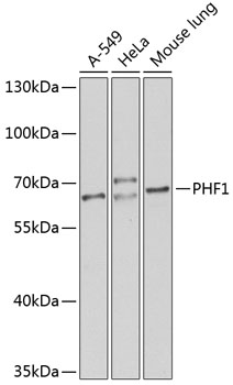 PHF1 Rabbit Polyclonal Antibod