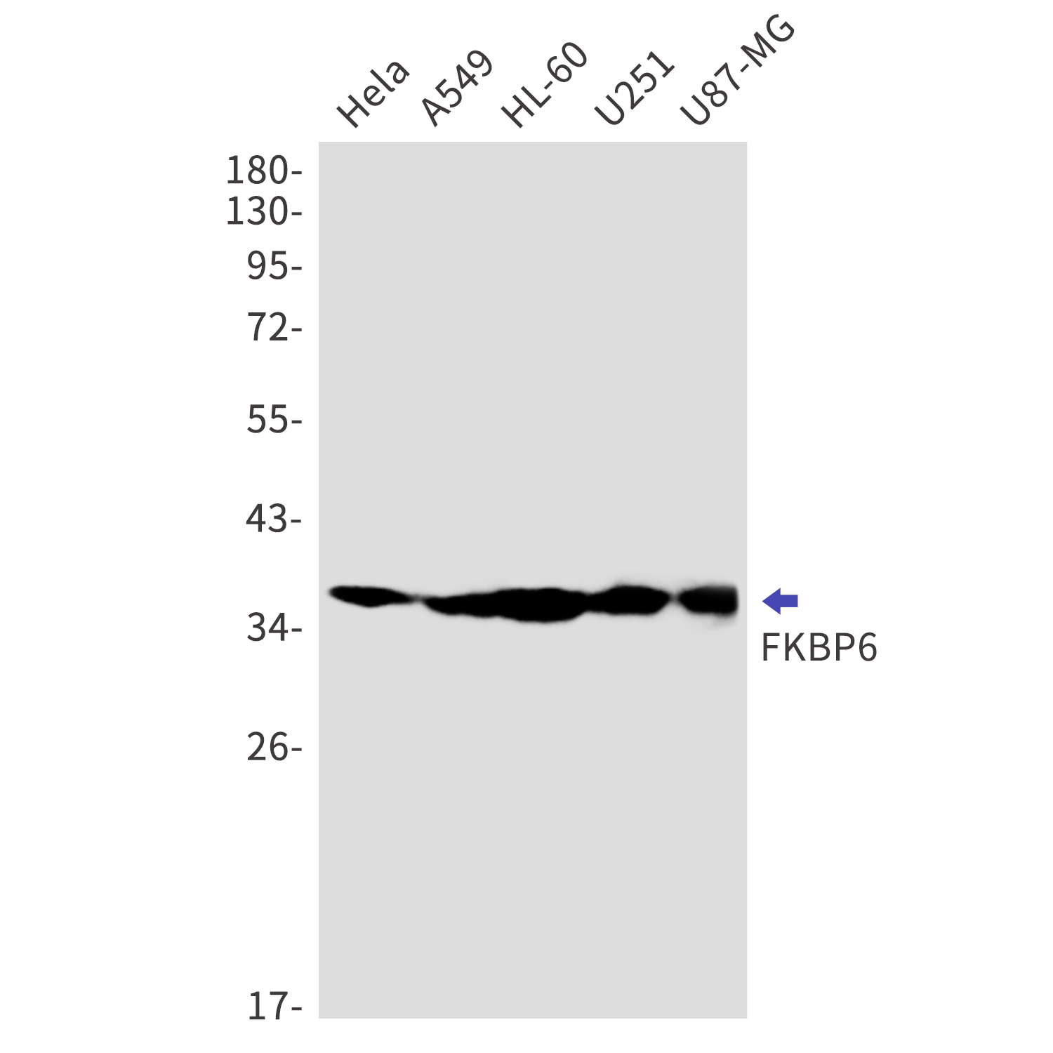 FKBP6 Rabbit mAb[52760]