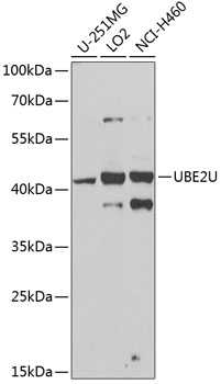 UBE2U Rabbit Polyclonal Antibo