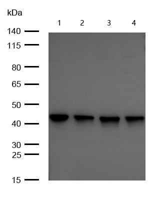 TRAM2 Rabbit mAb[56029]