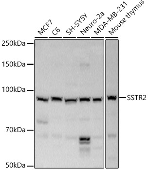 SSTR2 antibody[38600]
