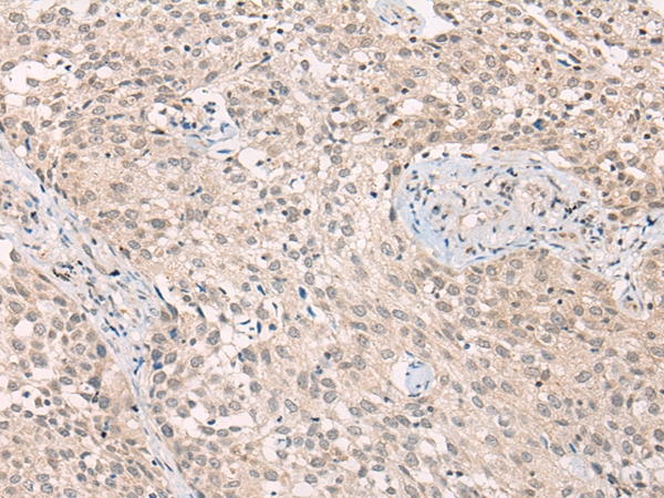 ADORA1 Antibody[43117]