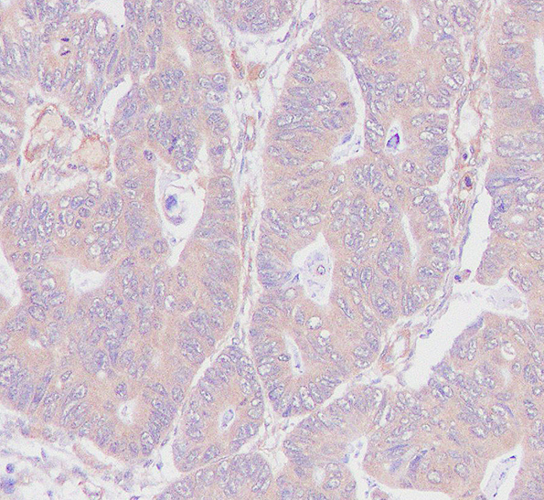 CSPG4 Rabbit mAb[59290]