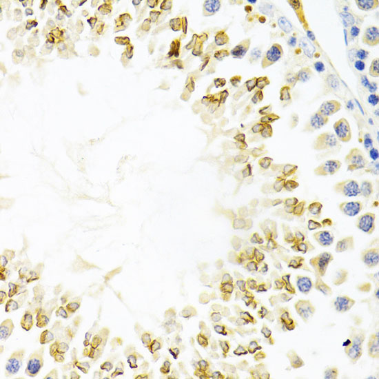 GEMIN2 antibody[38570]