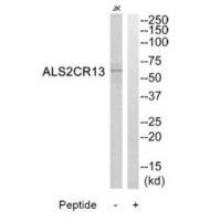 ALS2CR13 Antibody[34419]