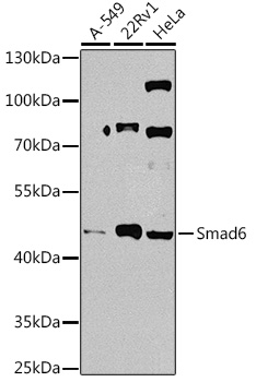 SMAD6 Polyclonal Antibody[2919