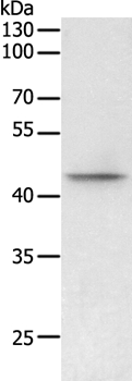 PHF6 Antibody[35894]