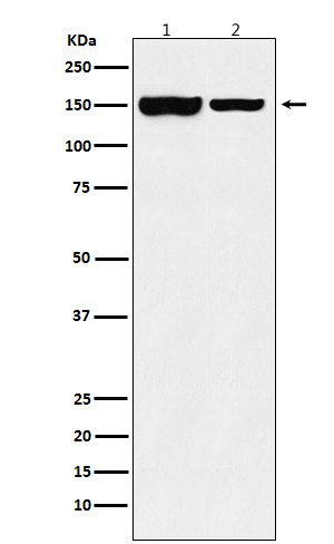 KDM4B / JMJD2B Rabbit mAb[5666