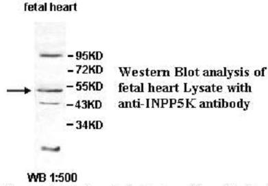 INPP5K Antibody[39560]