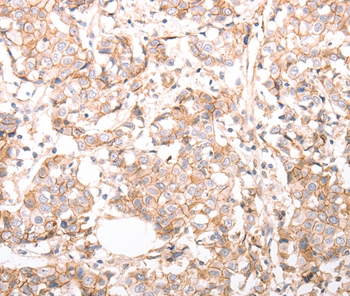 pan CDH Antibody[37301]