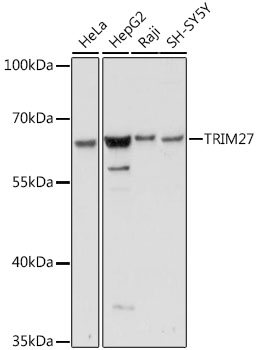 TRIM27 Rabbit Polyclonal Antib
