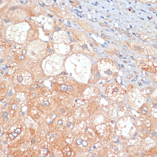 RIPK3 antibody[38654]