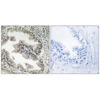 SH3GLB2 Antibody[35045]