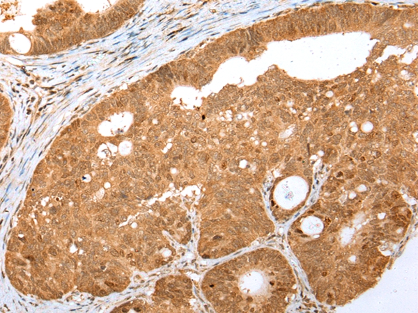 MKI67/ki67 Antibody[43095]