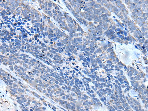 ITGA4 Antibody[43510]