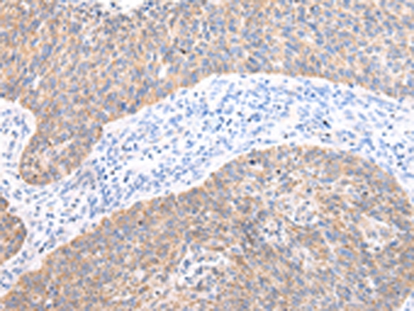 AXIN1  Antibody[43229]