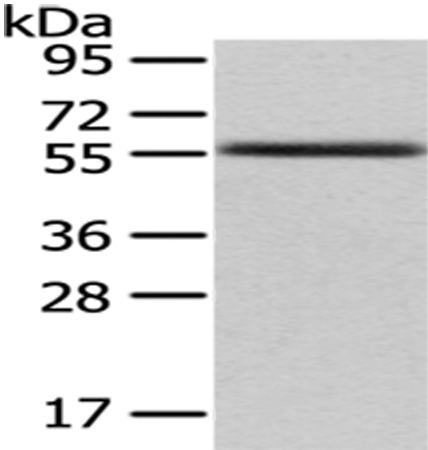 UMPS Antibody[43030]