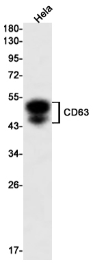 CD63 Rabbit mAb[52208]