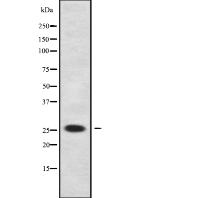 TCEAL2 Antibody[46281]