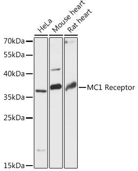 MC1R antibody[38533]