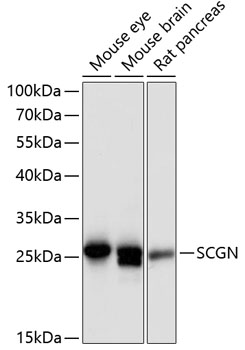 SCGN Rabbit Polyclonal Antibod