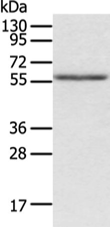 ACVRL1 Antibody[43246]