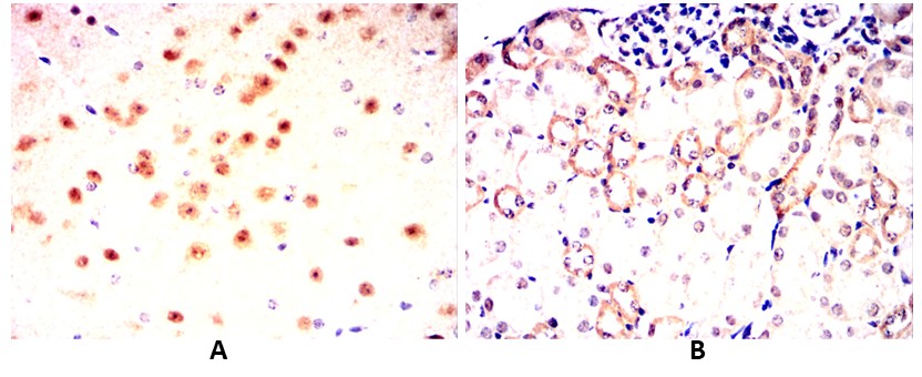 ATXN1 Mouse mAb[63121]