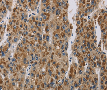 LOXL4 Antibody[36389]
