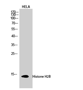 Histone H2B Polyclonal Antibod