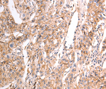 pan CDH Antibody[37301]