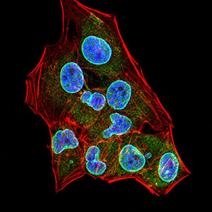 PSCA Mouse mAb[64132]