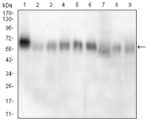 CAMK2G Mouse mAb[63190]